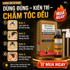 kích móc tóc MITOXESS-F